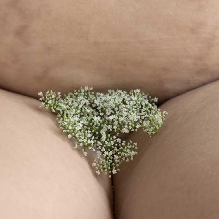 For genital reconstruction surgery, folks need at least one year of electrolysis hair removal in the surgical area. | Whimsical image of flowers over nude groin area.
