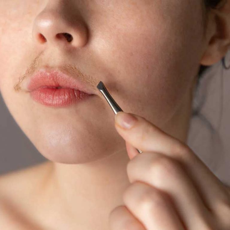 Unwanted hair can cause distress. You can zap it for good with electrolysis. | Hirsute woman shown.