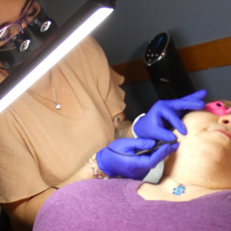 Trans women experiencing gender dysphoria due to facial hair find a real solution for permanent facial hair removal in electrolysis | Electrologist with client shown.